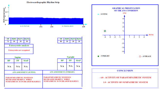 Screenshot 2026-10-19 093201 - Composite infographic titled 'Electrocardiographic Rhythm Strip': left side shows an ECG rhythm trace with SUPINE/Upright labels and tables; right side provides a framed plot comparing supine vs upright autonomic activity and a conclusion panel indicating changes in parasympathetic and sympathetic activity.
